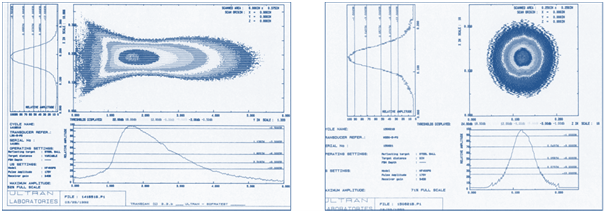 Graphical Image Showing Axial and Cross Sectional Beams Profile Graphical Image Showing Axial and Cross Sectional Beams Profile