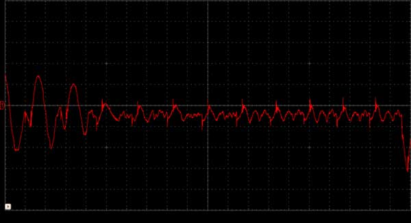 Typical Image of Brainwaves Observed on CRO